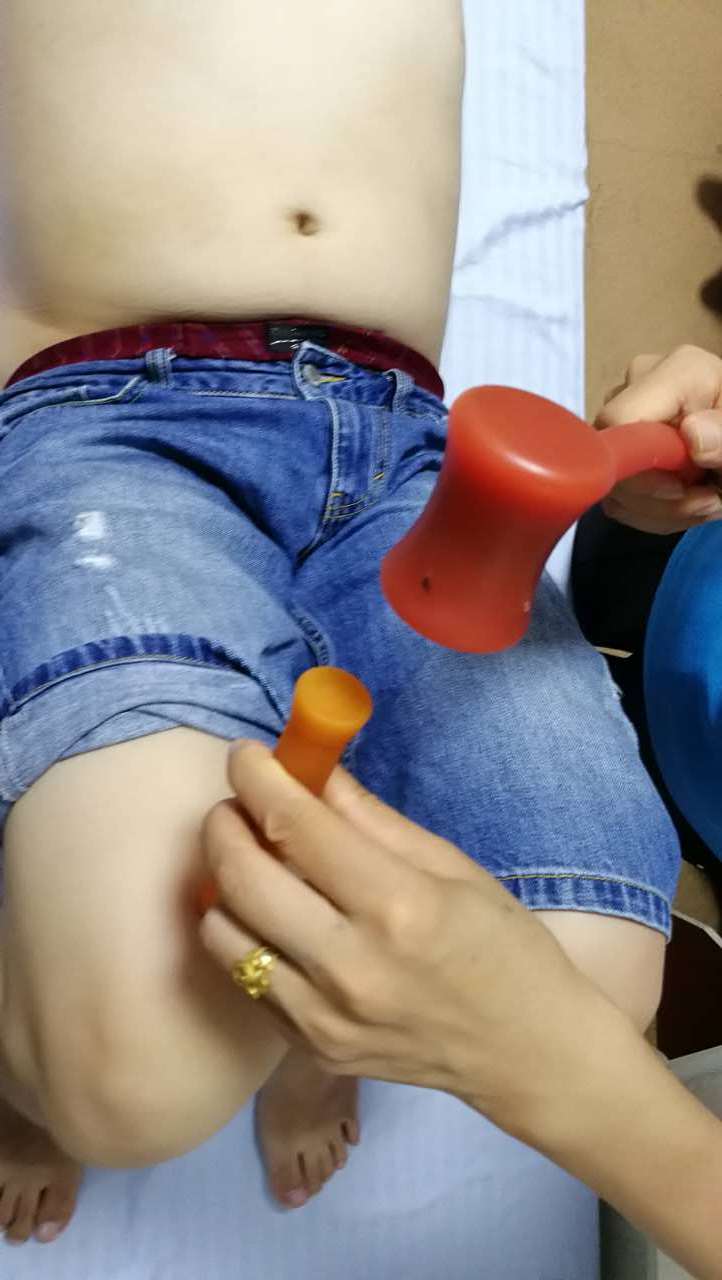 锤正疗法,锤正疗法工具,锤正疗法培训