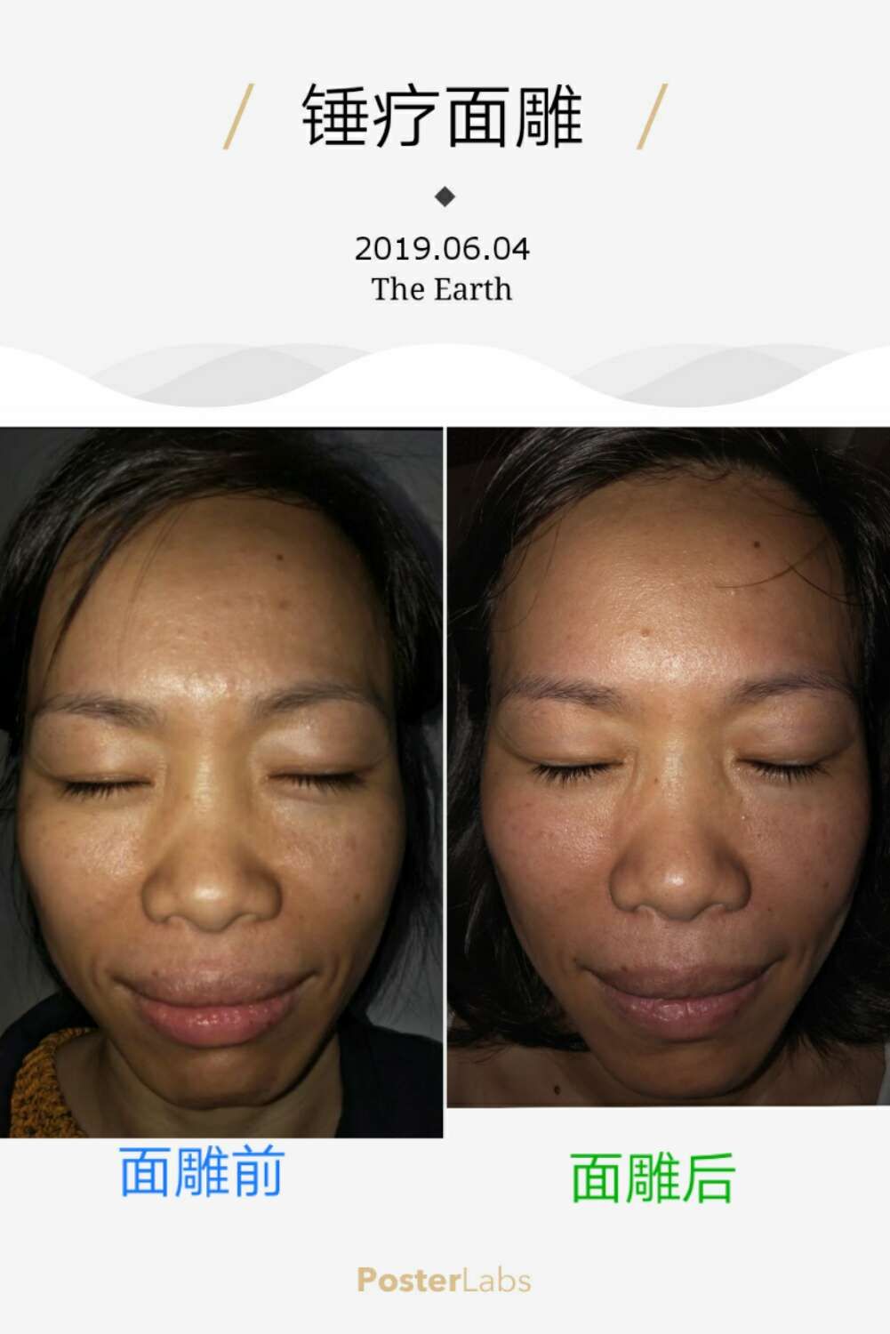 李华锤疗,面雕