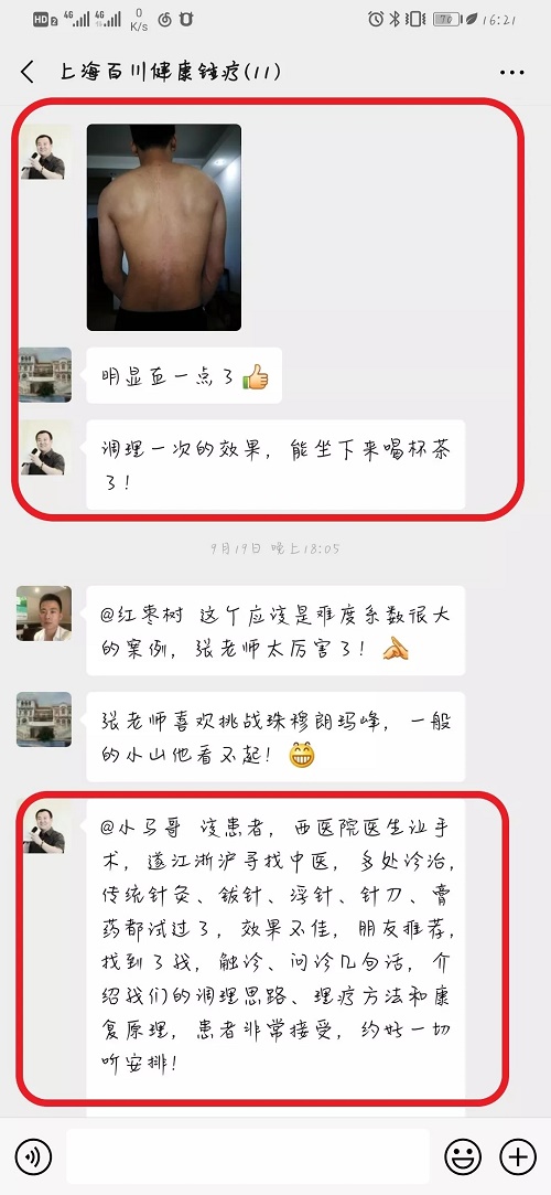 锤击疗法,锤击疗法工具,锤击疗法培训