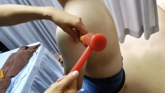 锤正疗法,锤正疗法工具,锤击疗法