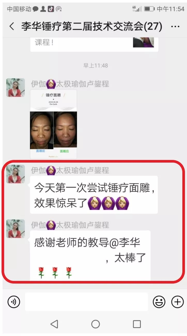 锤正疗法,锤正疗法工具,锤正疗法培训,面雕