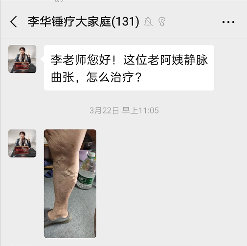 锤正疗法,锤正疗法工具,锤正疗法培训