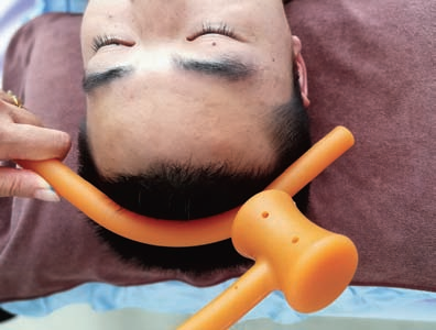 锤正疗法,锤正疗法工具,锤正疗法培训