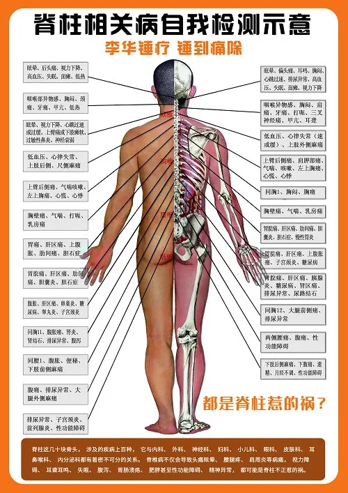 脊柱健康检测示意图,锤正疗法