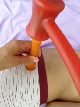 李华锤疗,锤正疗法,锤击疗法,臀部疼痛