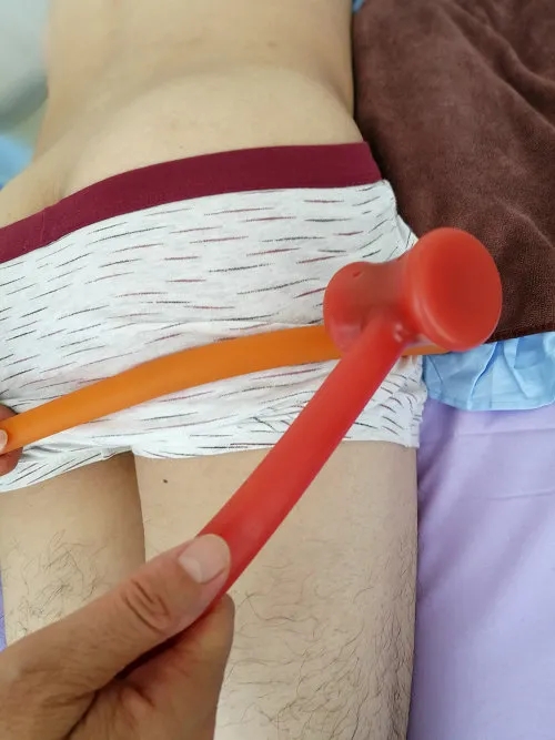 李华锤疗,锤正疗法,锤击疗法,臀部疼痛