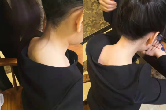 锤正疗法,锤正疗法工具,锤正疗法培训