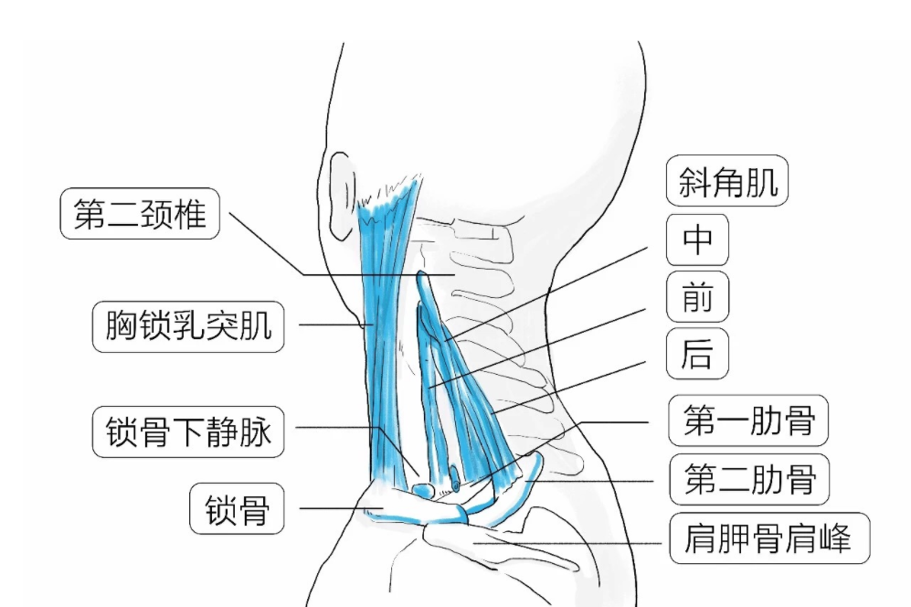 李华锤疗,锤正疗法,斜角肌