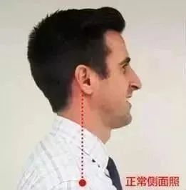 颈椎,锤击疗法,锤正疗法