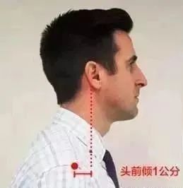 颈椎,锤击疗法