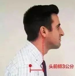 颈椎,锤击疗法,锤正疗法