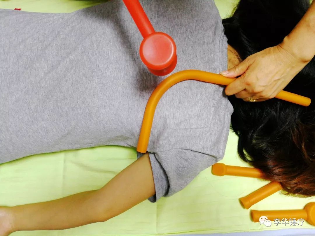 锤正疗法,锤正疗法培训,锤击疗法